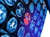 AVC, TROUBLES NEUROS Détecter fragilité capillaires cérébraux