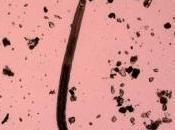 Stimuler gène partagé l'Homme pour réparer système nerveux