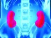 Conférence Internat Néphrologie -GM-