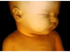 Après l'échographie, foetus pour futures mères, découvrez images
