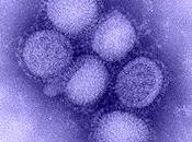 pandémies grippe XXème siècle
