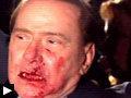 Video: Silvio Berlusconi frappé visage avec statuette