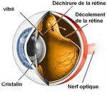 rétine Centre vision