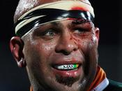 L'Afrique accueille France voilà titulaires