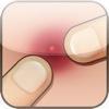 Pimple Popper Lite &#8211; Room Candy Games App. Gratuites pour iPhone, iPod