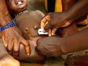 Mutilation génitale féminine tradition