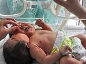 Chine Naissance d’un bébé deux têtes‎