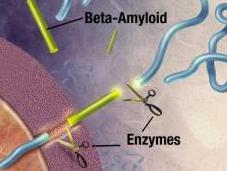 ALzeimer découverte “surprise” permet bloquer maladie
