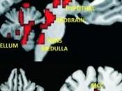 ACIDES GRAS, bons pour moral (mais coeur) Journal Clinical Investigation