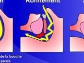 APNÉE sommeil: L’efficacité régime méditerranéen European Respiratory Journal