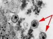VIH: protéine empêche virus reproduire Nature Immunology