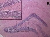 TOXOPLASMOSE ALZHEIMER: Toxoplasma gondii protège neurones PLoS
