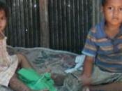 PIED-MAIN-BOUCHE, l’entérovirus bénin fait mortel Cambodge