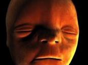 Reconstitution formation visage l’embryon