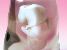 Obtenir réplique foetus, c’est possible
