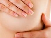CANCER SEIN: L’obésité accroît risque second cancer Breast Cancer Research Treatment