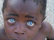 L'enfant noir yeux bleus