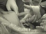 bébé tient doigt chirurgien juste avant naître