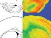 TRAUMATISMES L’ENFANCE, laissent marques cerveau Translational Psychiatry