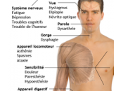 Symptomes Sclérose plaques (SEP)
