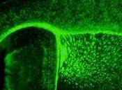 SCLÉROSE plaques: testostérone pour régénérer myéline CNRS Brain
