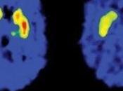 COCAÏNE: risque dépendance dans cerveau Biological Psychiatry