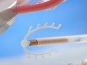 ACNÉ CONTRACEPTION): Plus d'AMM pour Diane ANSM