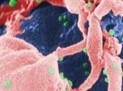VIH: Infection bien contrôlée, plus risque décès AIDS