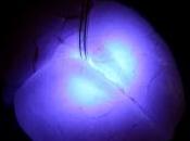 NEUROSCIENCES: miniaturisées pour éclairer l'intérieur cerveau Science