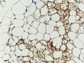 OBÉSITÉ: Transformer mauvaise graisse énergie Nature Cell Biology