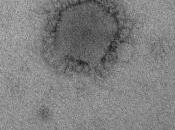 CORONAVIRUS NCoV: beaucoup doutes CDC-NIH-Nature