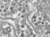 CORONAVIRUS NCoV: France, seul confirmé Ministère santé