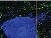 TRAUMA MOELLE ÉPINIÈRE: seule injection cellules souches neurales réparation Stem Cell Research Therapy