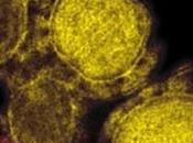 CORONAVIRUS MERS-NCoV: Premier confirmé Italie
