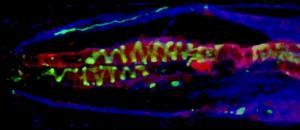 ALZHEIMER: Révélation agent double maladie Embo Journal