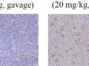 CANCER CÔLON: protéine soja combat métastase Journal Cancer Therapy