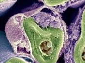 SCLÉROSE plaques: nouvelle cible pour restaurer myéline Nature Neuroscience