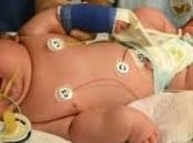 bébé sans césarienne