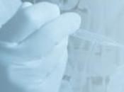 CANCER l'OVAIRE: CA-125, biomarqueur sanguin dépistage précoce Cancer