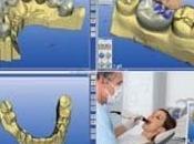 imprimantes révolutionnent dentisterie