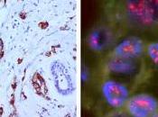 Lapatinib comme élément d’une thérapie néoadjuvante pour cancer sein HER2-positif opérable (NSABP protocol B-41): étude phase ouverte randomisée