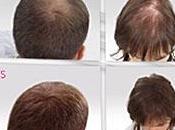 densifie cheveux