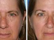 Peau tabac, cocktail explosif!