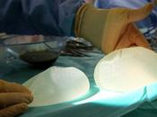Plus 17.000 femmes retirent leurs implants mammaires