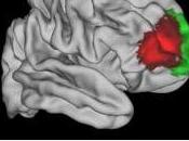 NEURO: Découverte d'une zone cérébrale unique l'Homme Neuron