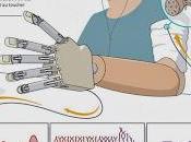 première prothèse bionique restaure sens toucher