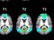 PERFORMANCE COGNITIVE: réflexion stratégique renforce capacité intellectuelle Frontiers Systems Neuroscience