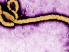 EBOLA: Recommandations prise charge suspects