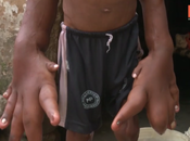 ans, enfant mains chacune