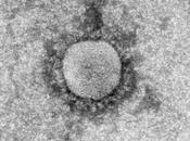 Tropisme réplication coronavirus syndrome respiratoire Moyen-Orient dromadaire dans tractus humain étude in-vitro ex-vivo
